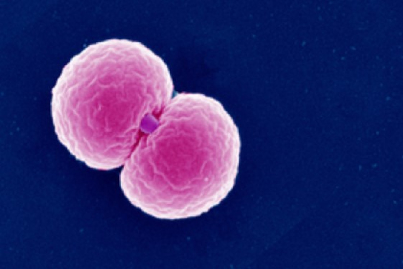 gonorrhoea-and-syphilis-diagnoses-reach-record-high-in-the-uk-according